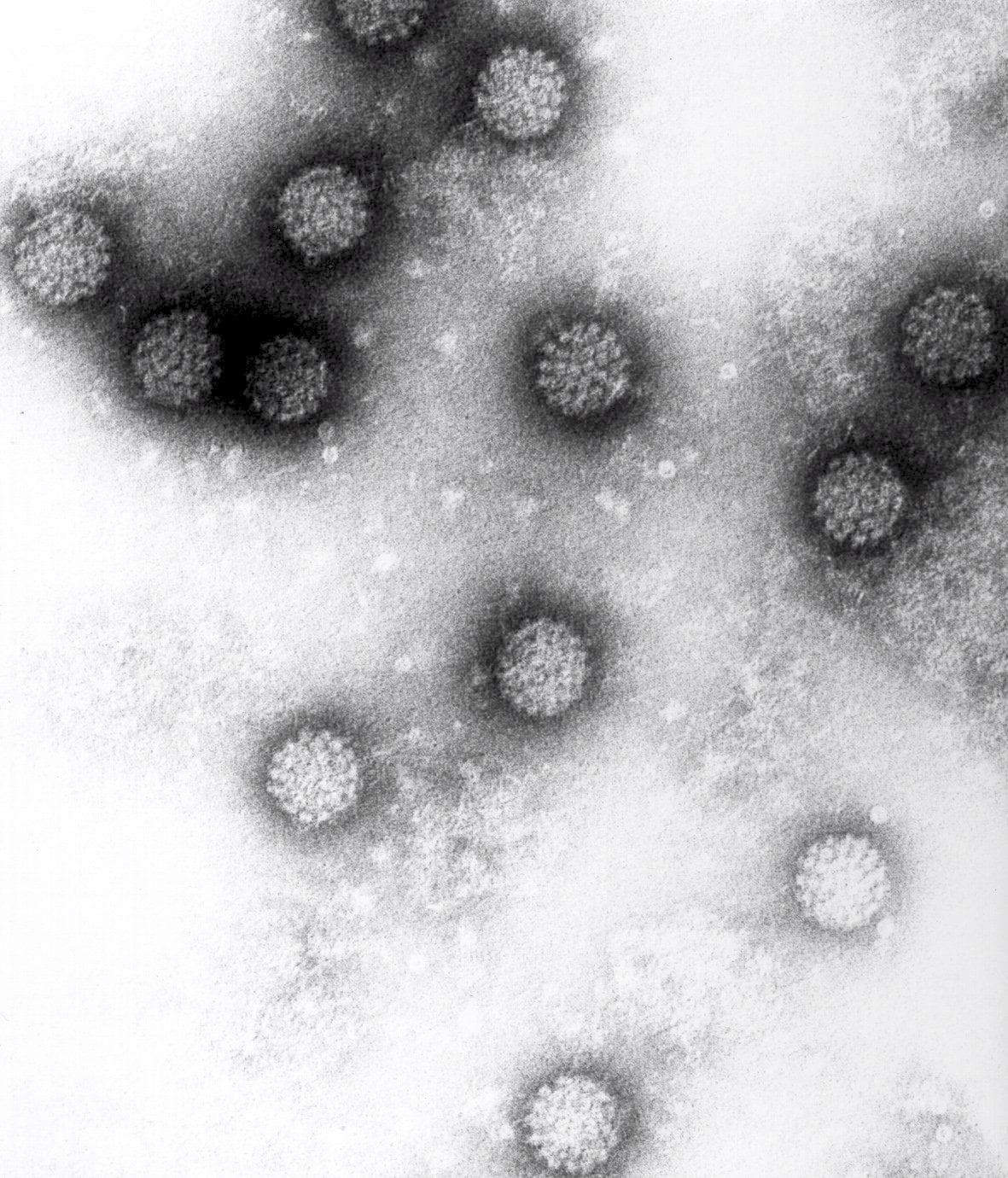 La vaccinazione contro il Papilloma virus Video Rai News