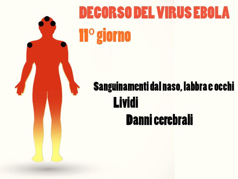 I segni e i sintomi tipici dell'infezione da Ebola Photogallery Rai